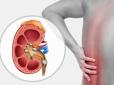 Не пропустіть! ТОП-5 ознак, які свідчать про камені в нирках